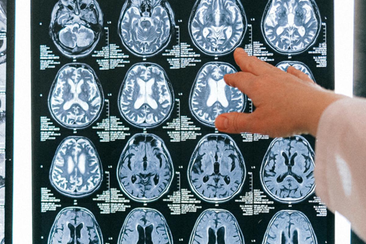 Brain Scan