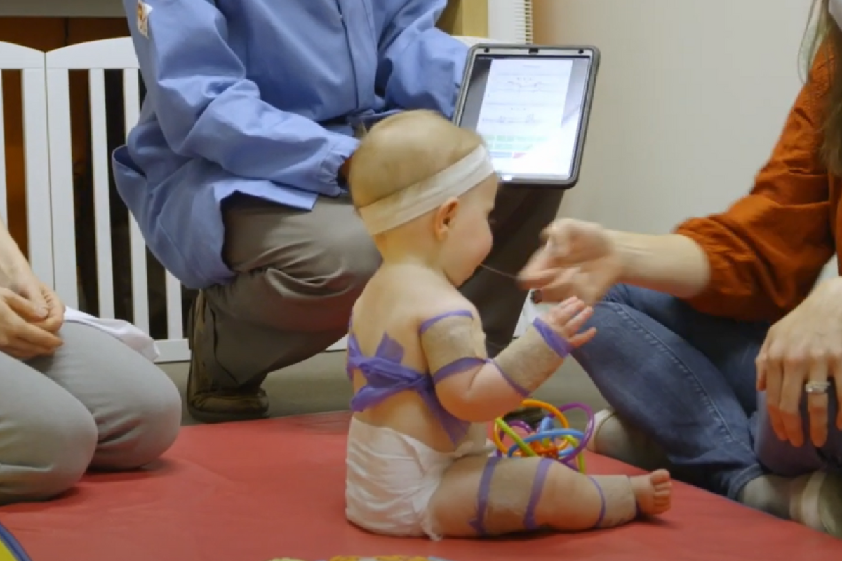 Wearable Sensors in Pediatrics