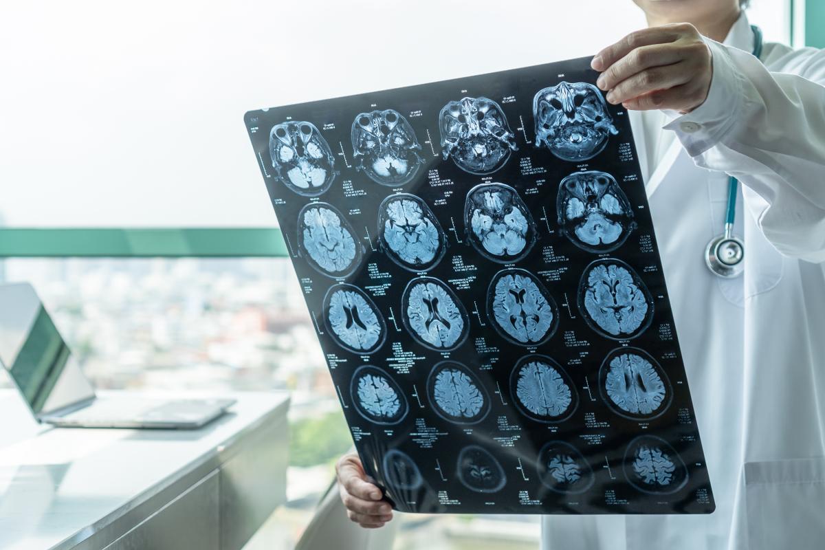 Brain Injury