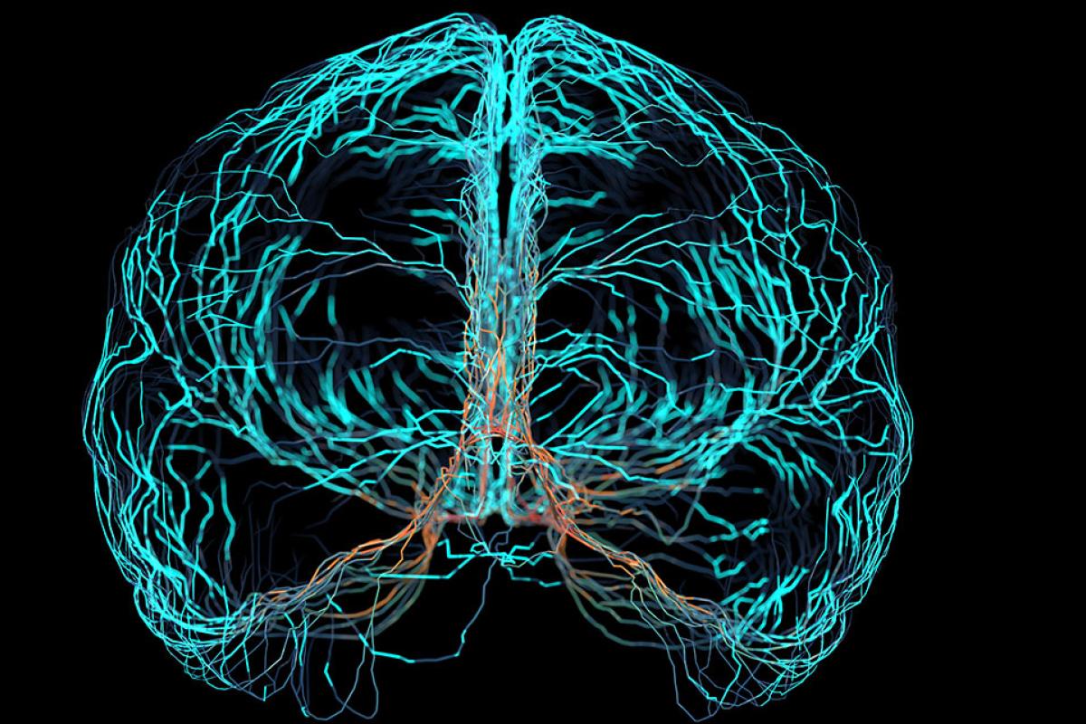 Brain scan