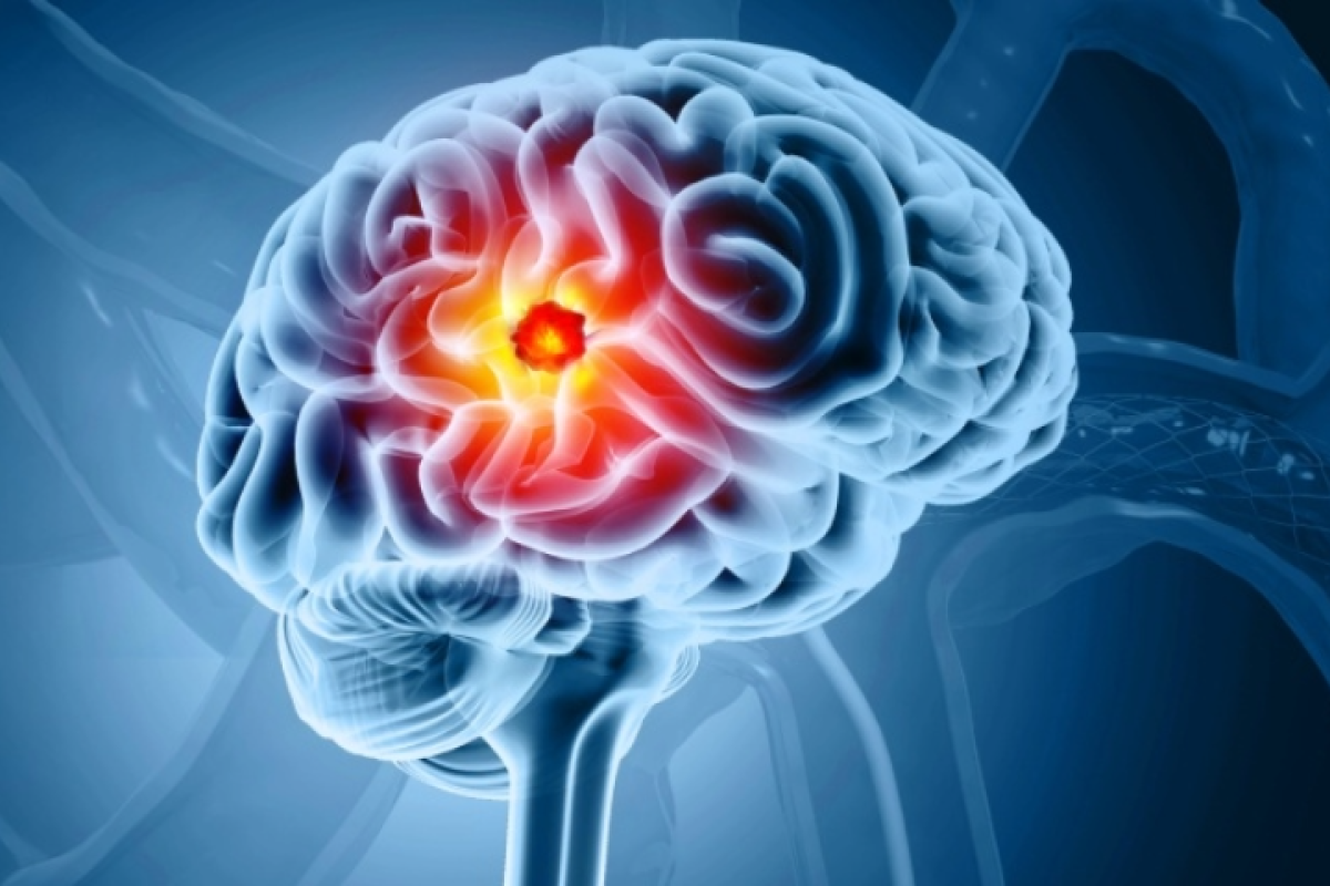 brain