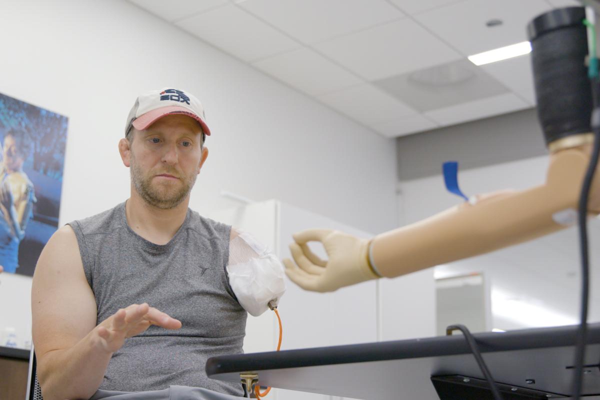 bionic arm