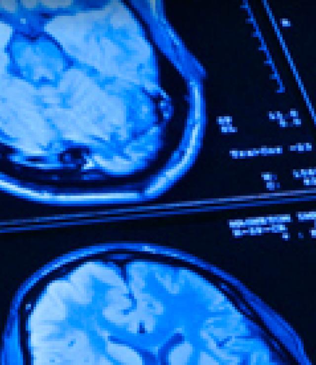 Intensive Comprehensive Aphasia Program