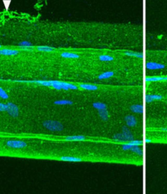 Collagen Cables