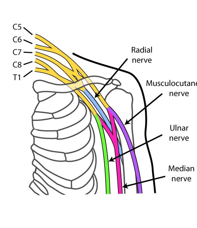 Diagram of nerves relevant in Targeted Muscle Reinnervation surgery