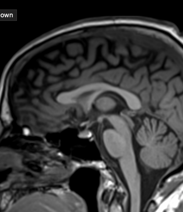 MRI is involved