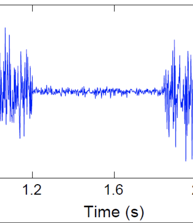 What EMG Signal may look like!
