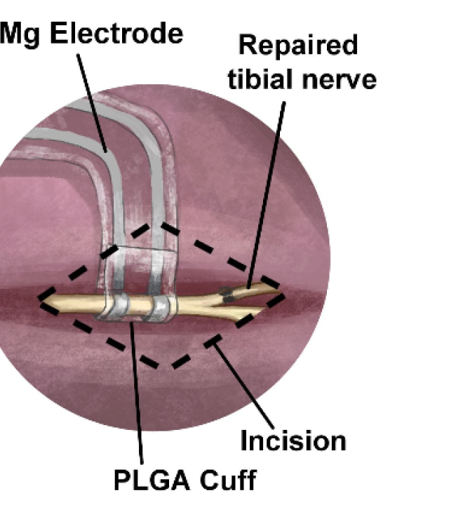 detail of repaired nerve