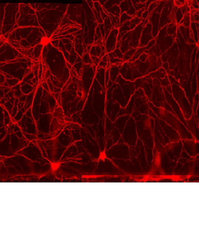 black and red microscopic somatal imagery