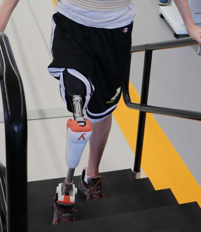 Hybrid Prosthetic Leg