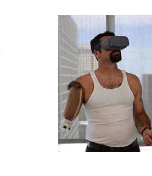 Virtual Reality to Treat Phantom Limb Pain