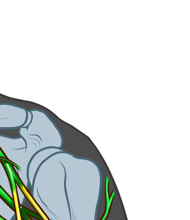Peripheral Nerve Injury