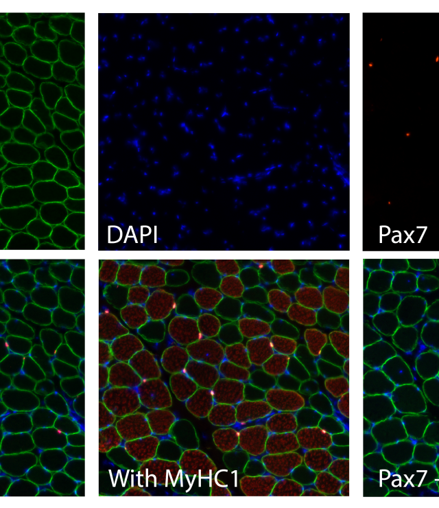 Muscle Stem Cells