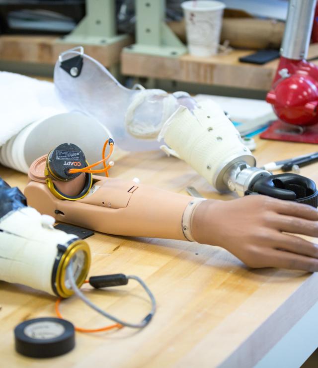 Example of upper limb prosthesis