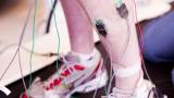Electrodes are used to measure motion