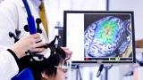 A high-resolution CT brain scan