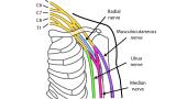 Diagram of nerves relevant in Targeted Muscle Reinnervation surgery