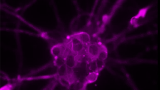 Human neurons for personalized rehabilitation medicine research that were derived using induced pluripotent stem cell technology in Dr. Franz's Laboratory of Regenerative Neurorehabilitation.