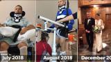 The progress made by Andy, a spinal cord injury patient