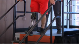 patient walking with new ai powered bionic leg