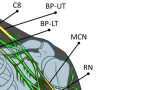 peripheral nerve damage illustration