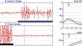 Kinematics and EMG reading charts