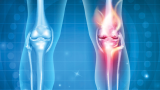 Medical illustration of a knee