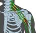 Peripheral Nerve Injury